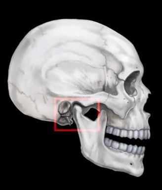 턱에서 소리가 난다면 턱관절 질환일 수 있습니다.