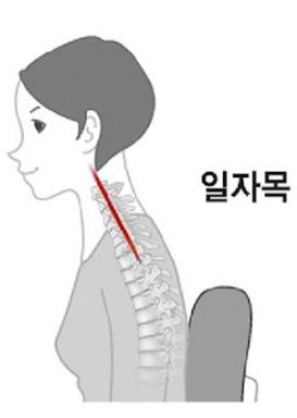일자목으로 인한 통증과 스트레칭 및 운동방법