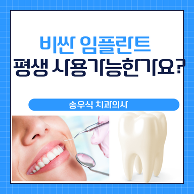 임플란트를 하면 평생 사용이 가능한가요? 임플란트 유지기간, 수명