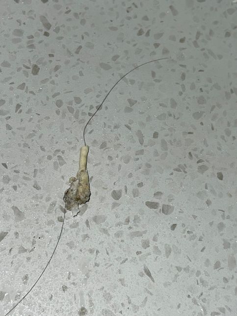 화장실 배수구망.?. 청소 하다 보인 건데 이게 뭔가요 어쩐지 물이 잘 안 내려가서 뜯어 보니 저런게 붙어 있았습니다 벌레 알 같은 걸까요..?의 1번 째 이미지