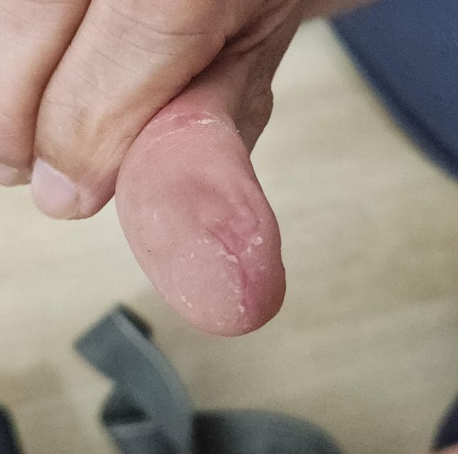 남편 손이... 로션을 발라도 건조하다고의 0번 째 이미지