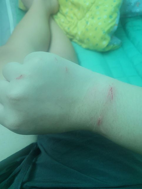 안녕하세요 여러분제가 고양이 한테 물렸러용 어떻게 해야되나요?의 0번 째 이미지