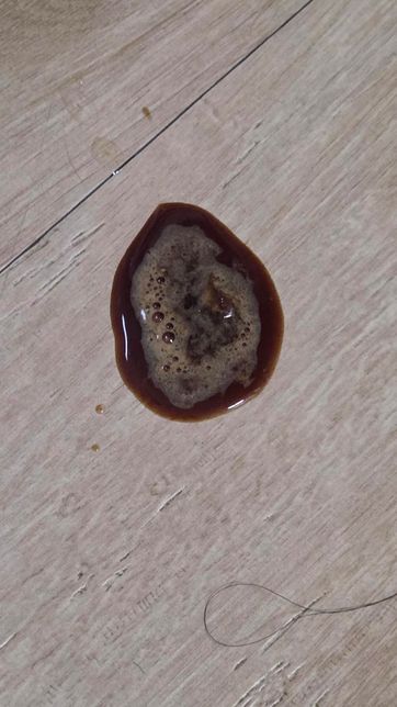 고양이 구토 색이 갈색이랑 피 색깔이 좀 있어요의 0번 째 이미지