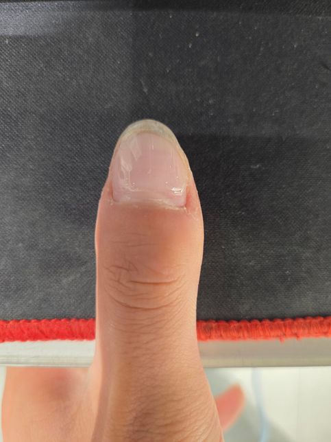 05년생 남자입니다.젤네일에 대해서 고민이 있습니다.의 1번 째 이미지