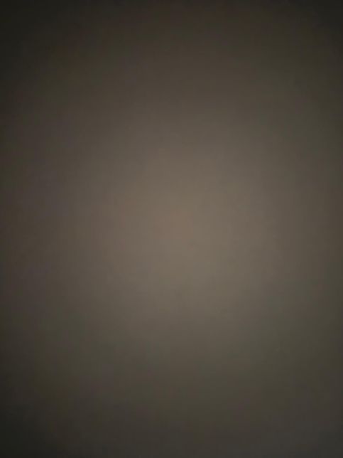 뾰루지 질문삭제 질문삭제 질문 삭제 +의 1번 째 이미지