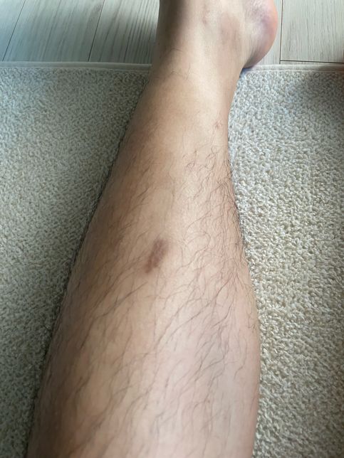 1년 전 공무수행 중 부상 지금이라도 보상 가능?의 0번 째 이미지