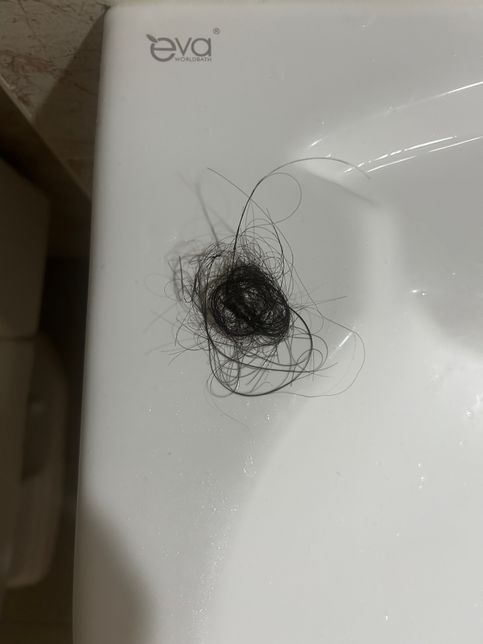 이거 탈모인가요????..?.?의 2번 째 이미지