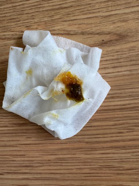 강아지가 점액변 설사를 합니다. 왜 그러는거죠?의 2번 째 이미지