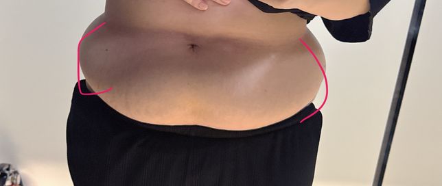 이 부분 살은 어떻게 뺄 수 있나요??!의 0번 째 이미지