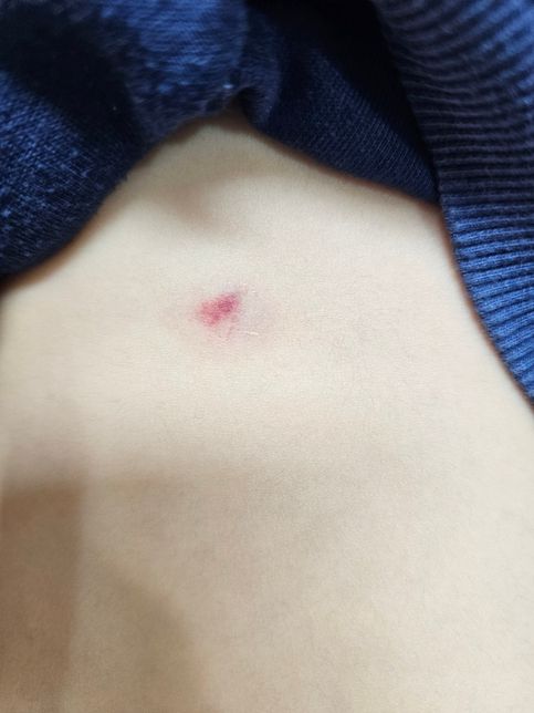 어린이집다니는 5살아들이 친구를 물었는데 어떻게해야죠?의 0번 째 이미지