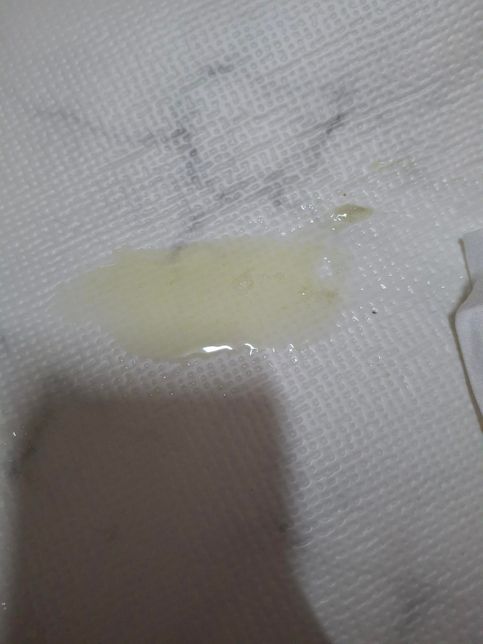 강아지가 녹색의 묽은 토를 한 것은 어떤 증상인가요의 0번 째 이미지