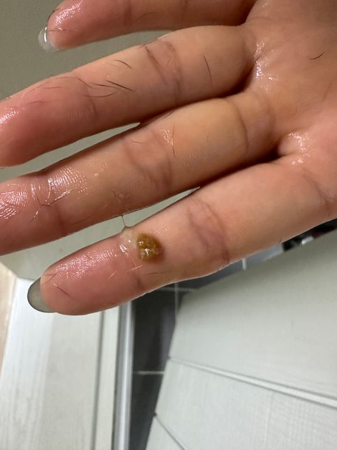 강아지 항문낭 짜면 이렇게 나오는게 정상인가요?의 1번 째 이미지