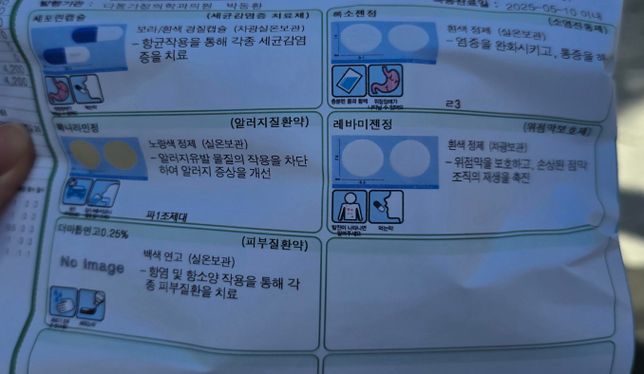 상처 알러지 약 복용후 음주 괜찮나요?의 0번 째 이미지