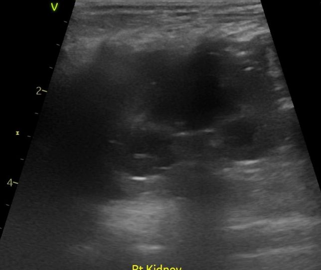 강아지 신장결석 칼슘옥살 스트루바이트 둘중 어느것 같아보이는지요?의 1번 째 이미지