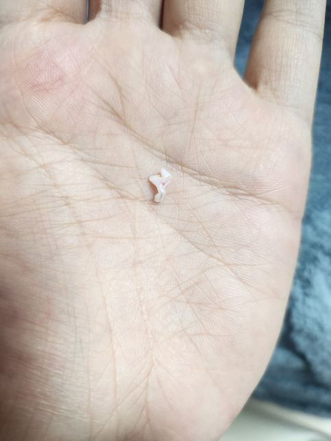 강아지 이가 빠졌는데 유치인지 영구치인지의 0번 째 이미지