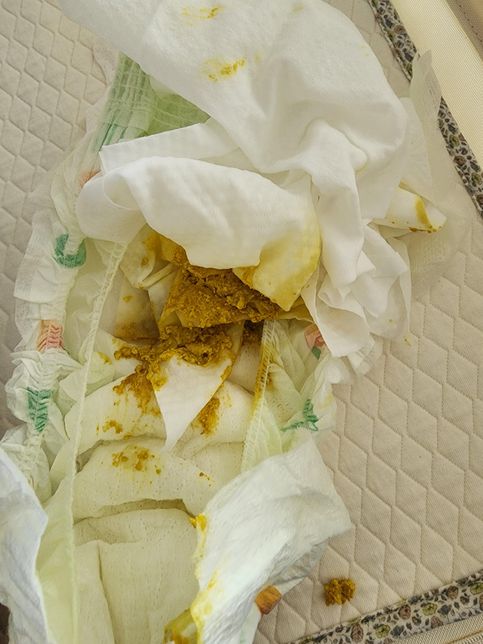 신생아 생후 28일 아기변 봐주세요ㅜㅜ의 0번 째 이미지