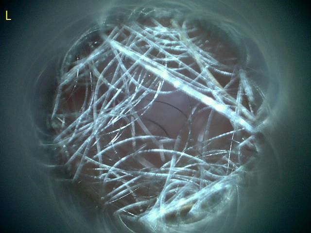 강아지 검이겸 그리고 현미경 검사 결과좀 봐주시면 감사하겠습니다.의 3번 째 이미지