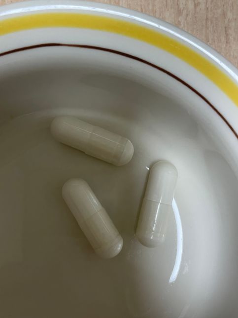 쿠팡 영양제 가품 논란... 제가 구매한 영양제는 가품인지, 정품인지 알 수 있을까요?의 3번 째 이미지