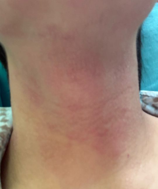 디판테놀연고 혹은 비판텐 연고 둘중 고민이에여의 0번 째 이미지