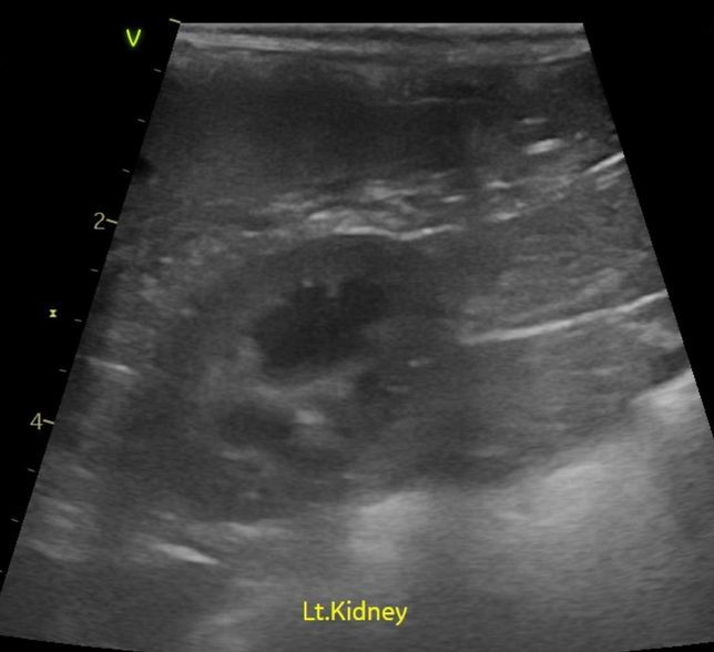 강아지 신장결석 칼슘옥살 스트루바이트 둘중 어느것 같아보이는지요?의 3번 째 이미지