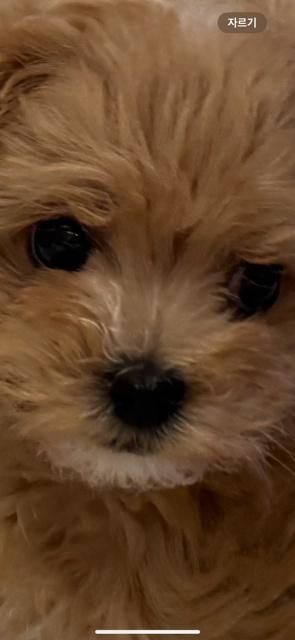 정확한 사시증상이랑 사시일까요?? 치료 받아야 할까요?의 1번 째 이미지