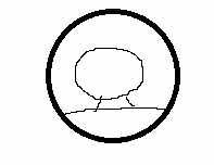 이런 경우 아청물로 판단될 수 있나요?의 0번 째 이미지