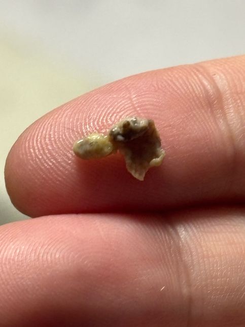 노령견인데 재채기 하니까 노란 덩어리가 나와요의 0번 째 이미지