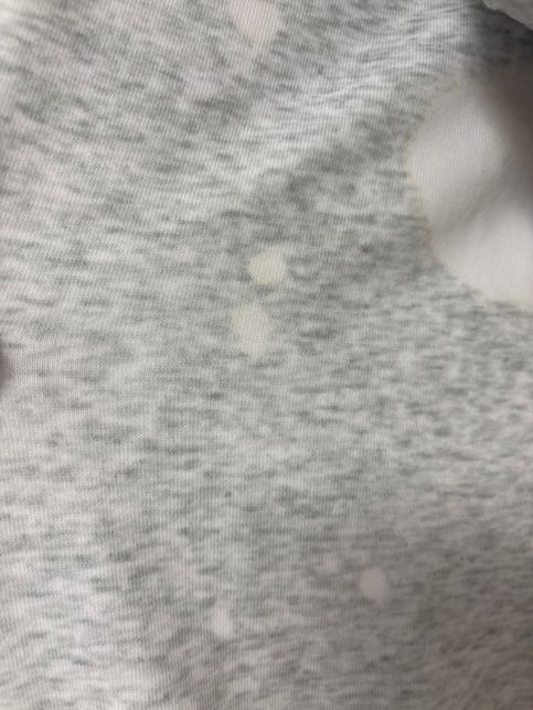 후드티에 누렇고 하얀 얼룩이 생겼어요의 2번 째 이미지