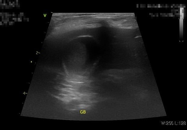 강아지 담낭 한번 봐주시면 감사하겠습니다의 1번 째 이미지