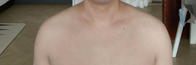 어깨 짝짝이 불균형 어떤운동 어느부위를 키워주면 좋을까요의 0번 째 이미지