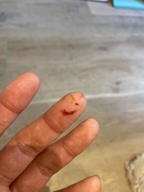 강아지가 노란토를 하고 이제는 토하고 익룡 소리 내며 울어요의 0번 째 이미지