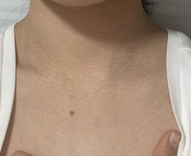 목주름 없애는 법 알려주실분 구합니다의 0번 째 이미지