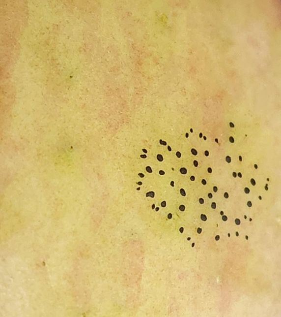 사과 껍질에 있는 검은 작은점들 뭘까요?의 0번 째 이미지