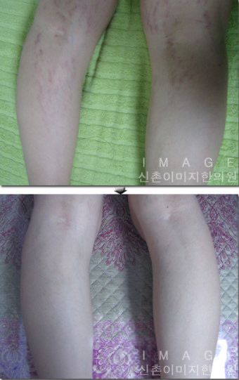 사람 살린다 치고 제발 도와주세요….의 1번 째 이미지