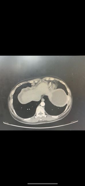 복부 ct 영상 판독부탁드립니다.!의 3번 째 이미지