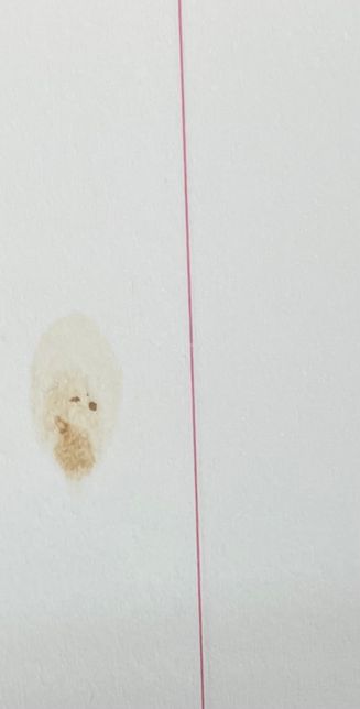 새책을 보다보면 종이에 누런 자국이 있는데 무엇인가요?의 0번 째 이미지