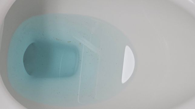 변기 안 주황색 점들(한달째 안지워지는)의 0번 째 이미지