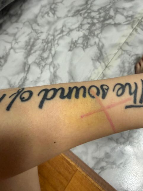 폭행 사건 합의금은 얼마까지가 적당할까요..?의 3번 째 이미지