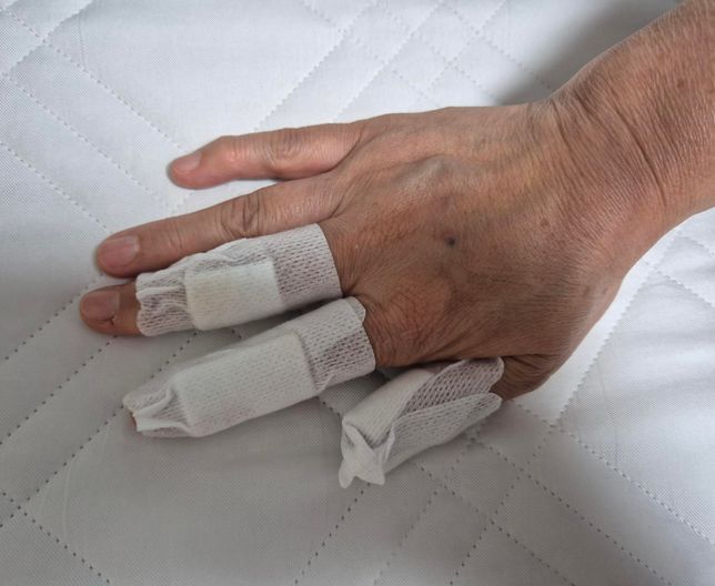 어머니께서 철수세미에 손이 많이 베였어요의 1번 째 이미지