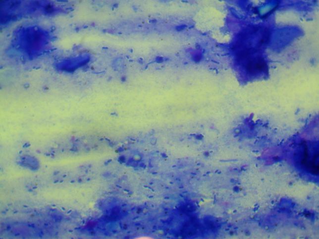 강아지 분변검사에서 간균 이 많다는데.. 이런 경우 치료를 다른 병원들은 어떻게 하나요?의 3번 째 이미지