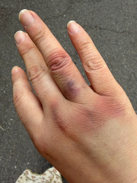 남편이 가정폭력을휘둘러서여,어트케해야힐지모르겟어요의 0번 째 이미지