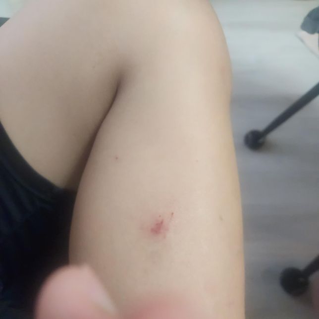 강아지한테 물림사고 괜찮나요???의 1번 째 이미지