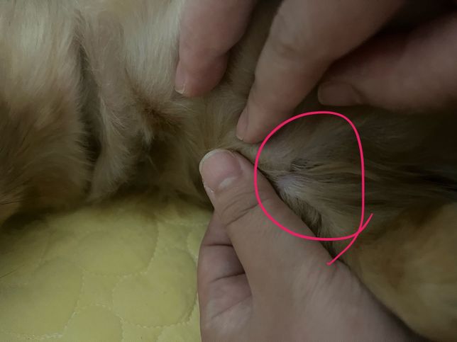 주사바늘자국인가요? 다른 기구에 눌린자국인가요?의 3번 째 이미지