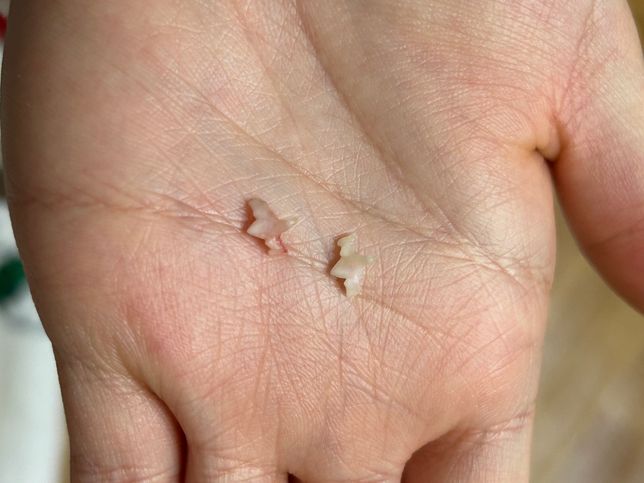 5개월 고양이 유치인 것 같은데 치아가 이상해요의 0번 째 이미지