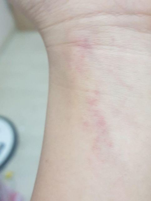 사진이 애견묘에 긇혀서 생긴 상처인가요??의 0번 째 이미지