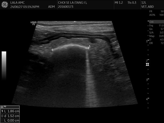 강아지 몸속에 1.8cm물체가 있는것 같다는데 뭔지 모르겠어요의 3번 째 이미지