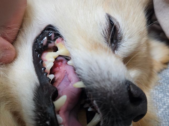 tongue bite syndrome/종양 어떤걸로 보이시나요?의 1번 째 이미지