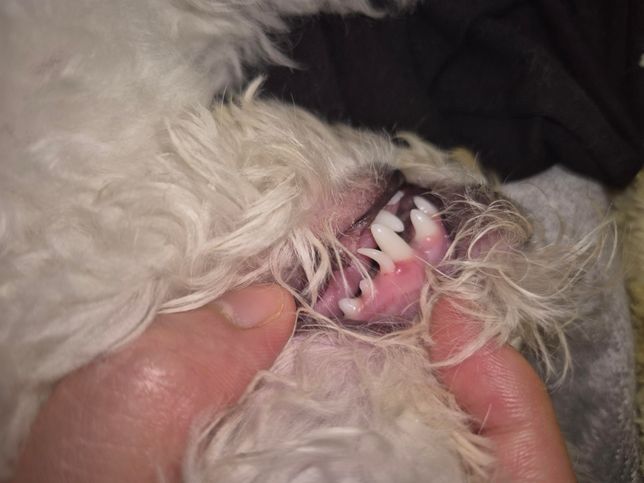 생존유치가 흔드릴고 피가 나고 잇몸이부었어요의 0번 째 이미지