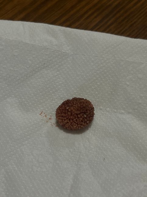 강아지 방광결석 대충 어떤 종류인 거 같나요?의 0번 째 이미지