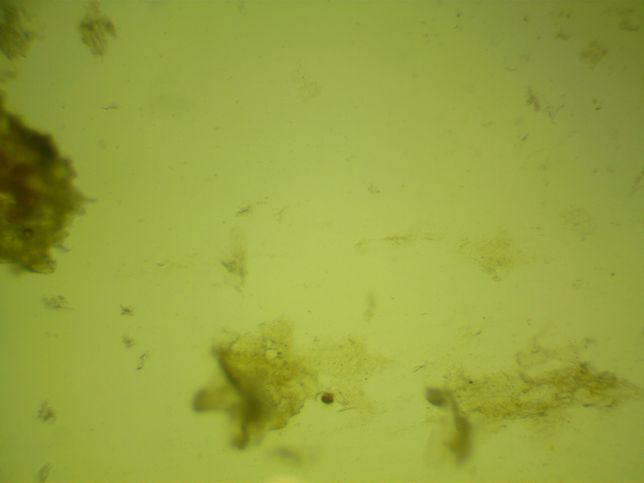 강아지 분변검사에서 간균 이 많다는데.. 이런 경우 치료를 다른 병원들은 어떻게 하나요?의 2번 째 이미지